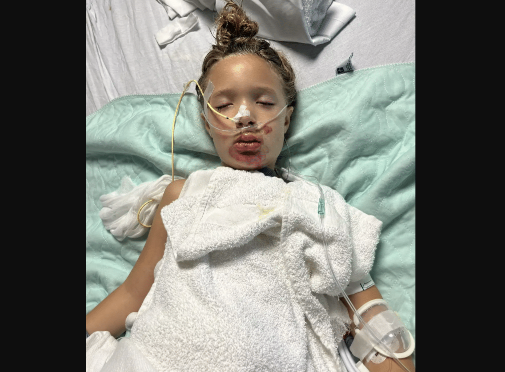 7-Year-Old Girl in Coma After Popular Toy Explodes