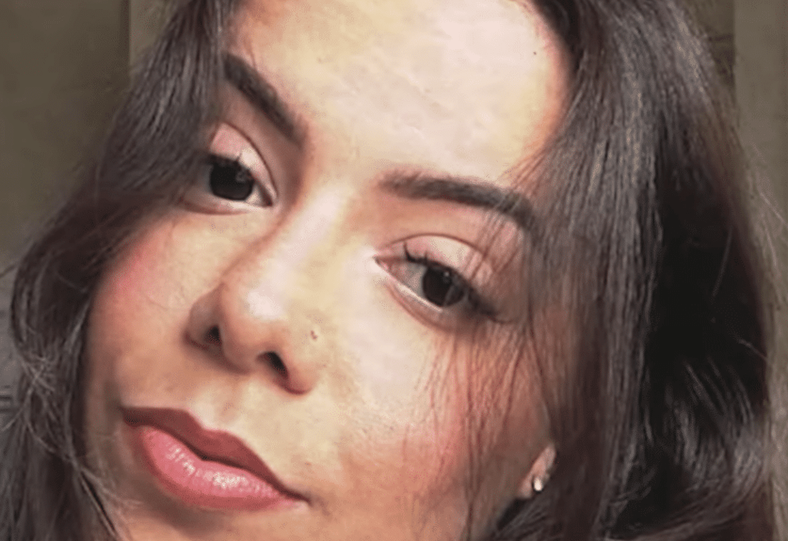 Police Officer Dies After Cosmetic Surgery